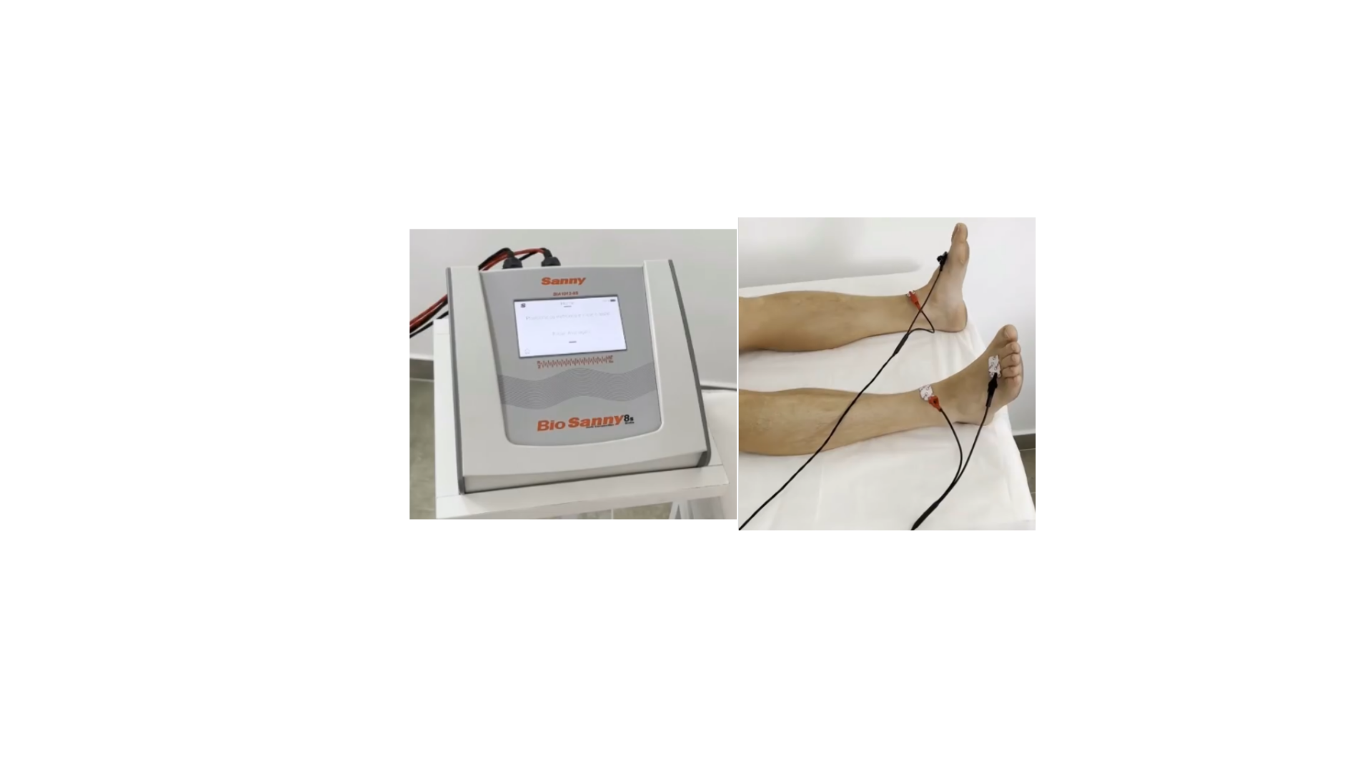 Avaliação da composição corporal por bioimpedância octopolar segmentada